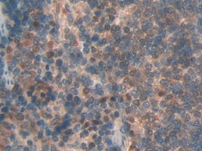 Lectin Like Oxidized Low Density Lipoprotein Receptor 1 (LOX1) Polyclonal Antibody - image 5