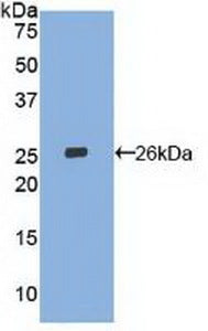 DAB staining on IHC-P; Samples: Human Kidney Tissue;  Primary Ab: 20μg/ml Rabbit Anti-Human LOX1 Antibody Second Ab: 2µg/mL HRP-Linked Caprine Anti-Rabbit IgG Polyclonal Antibody