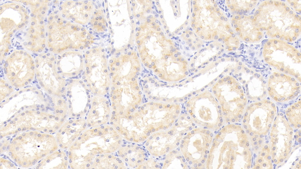 Lectin Like Oxidized Low Density Lipoprotein Receptor 1 (LOX1) Polyclonal Antibody - image 4