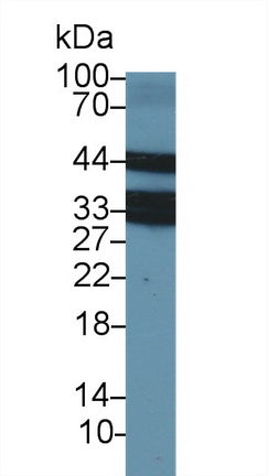 Western Blot; Sample: Recombinant protein.