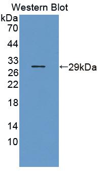 DAB staining on IHC-P; Samples: Bovine Kidney Tissue; Primary Ab: 20μg/ml Rabbit Anti-Bovine LOX1 Antibody Second Ab: 2µg/mL HRP-Linked Caprine Anti-Rabbit IgG Polyclonal Antibody