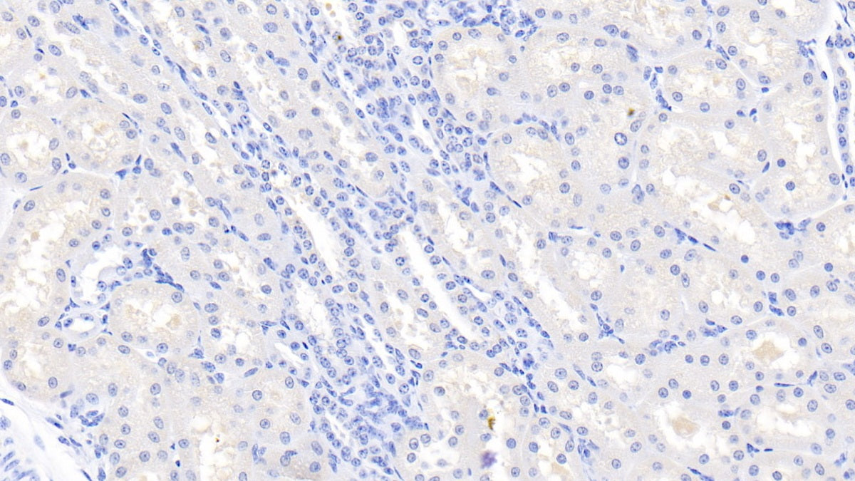 DAB staining on IHC-P; Samples: Bovine Cardiac Muscle Tissue;  Primary Ab: 20μg/ml Rabbit Anti-Bovine LOX1 Antibody Second Ab: 2µg/mL HRP-Linked Caprine Anti-Rabbit IgG Polyclonal Antibody