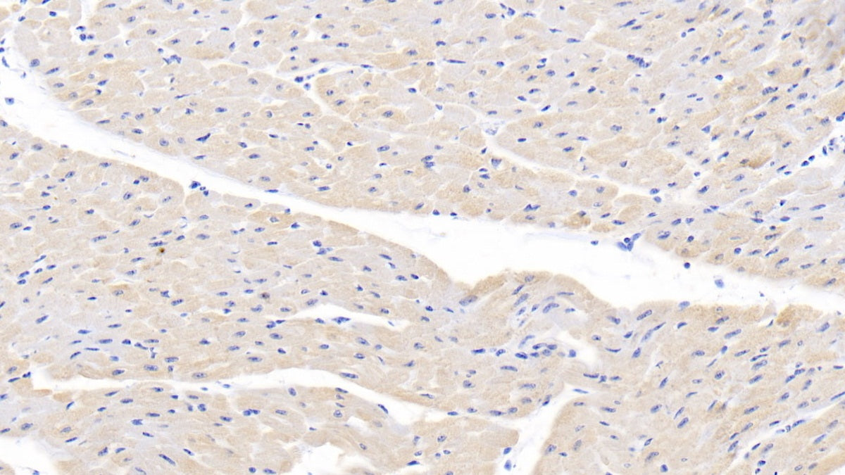 Lectin Like Oxidized Low Density Lipoprotein Receptor 1 (LOX1) Polyclonal Antibody - image 5
