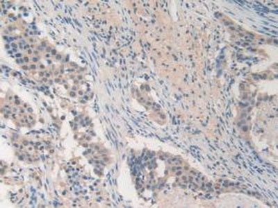 Matrix Metalloproteinase 19 (MMP19) Polyclonal Antibody - image 5