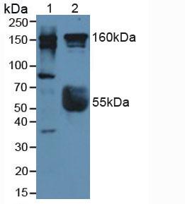 Western Blot; Sample: Recombinant Rock2, Human.