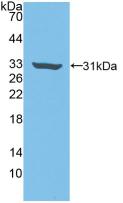 DAB staining on IHC-P; Samples: Human Stomach Tissue; Primary Ab: 20µg/ml Rabbit Anti-Human Rock2 Antibody Second Ab: 2µg/mL HRP-Linked Caprine Anti-Rabbit IgG Polyclonal Antibody