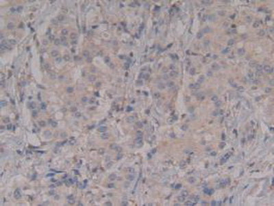 Rho Associated Coiled Coil Containing Protein Kinase 2 (Rock2) Polyclonal Antibody - image 5