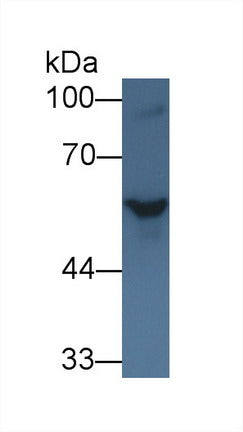 Western Blot; Sample: Recombinant protein.