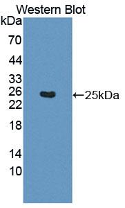 DAB staining on IHC-P; Samples: Rat Kidney Tissue; Primary Ab: 20µg/ml Rabbit Anti-Rat SHH Antibody Second Ab: 2µg/mL HRP-Linked Caprine Anti-Rabbit IgG Polyclonal Antibody