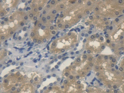 DAB staining on fromalin fixed paraffin- embedded Kidney tissue)