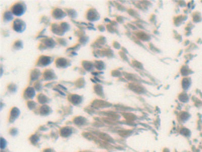 Hedgehog Homolog, Sonic (SHH) Polyclonal Antibody - image 5