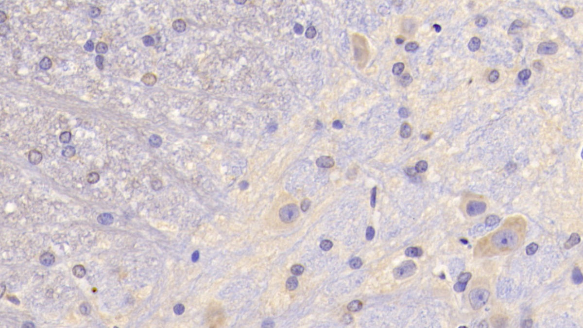 DABstainingonIHC-P.Samples:RatTissue)