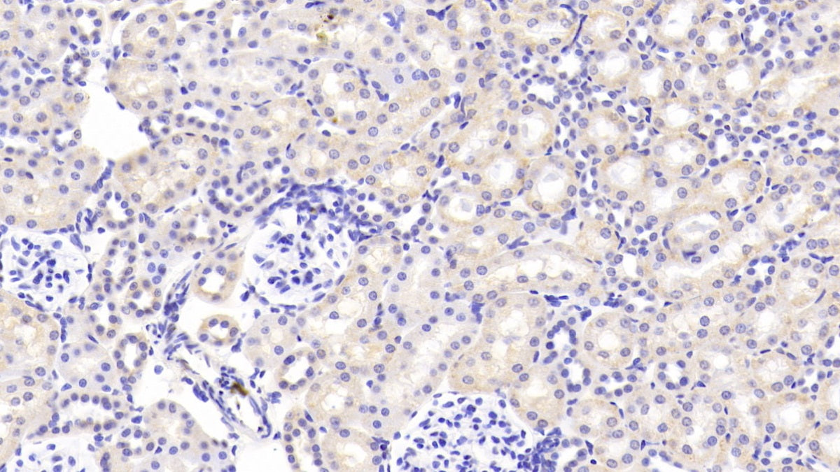 Hedgehog Homolog, Sonic (SHH) Polyclonal Antibody - image 4