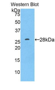 A Disintegrin And Metalloprotease 9 (ADAM9) Polyclonal Antibody - image 2