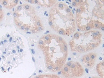 A Disintegrin And Metalloprotease 9 (ADAM9) Polyclonal Antibody - image 4
