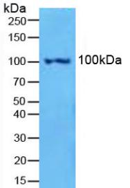 Western Blot; Sample: Recombinant NFkB2, Human.