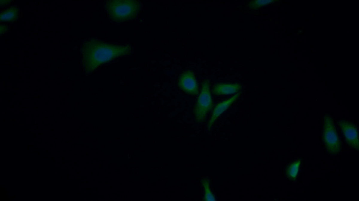 Nuclear Factor Kappa B (NFkB) Polyclonal Antibody - image 3