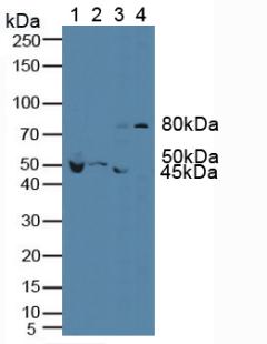 Western Blot; Sample: Recombinant VEGFR1, Mouse.