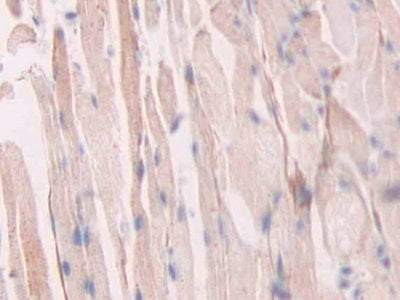 DAB staining on IHC-P; Samples: Mouse Uterus Tissue.