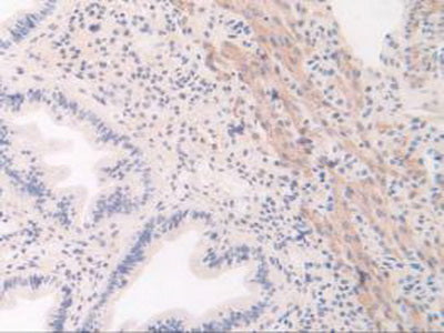 Vascular Endothelial Growth Factor Receptor 1 (VEGFR1) Polyclonal Antibody - image 5