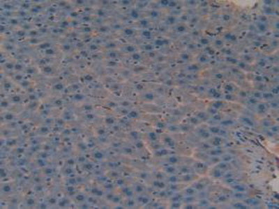 Versican (VCAN) Polyclonal Antibody - image 5