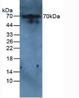 Western Blot; Sample: Recombinant protein.