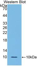 Interleukin 6 Receptor (IL6R) Polyclonal Antibody - image 3