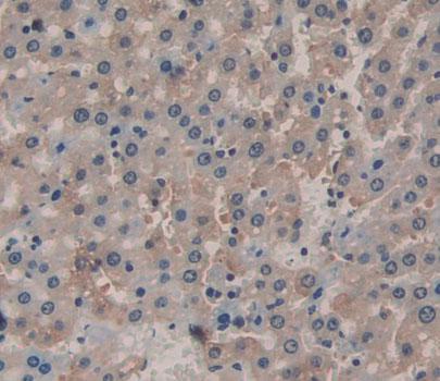 Interleukin 6 Receptor (IL6R) Polyclonal Antibody - image 4