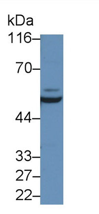 Interleukin 6 Receptor (IL6R) Polyclonal Antibody - image 2