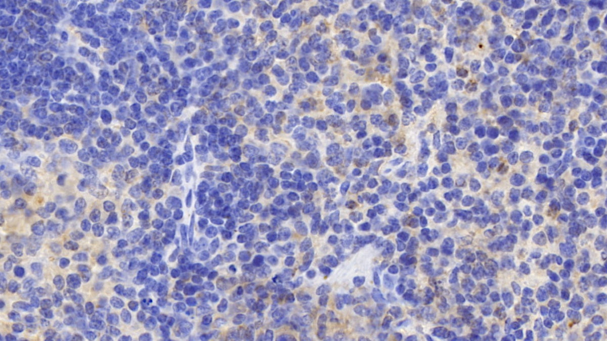 Interleukin 6 Receptor (IL6R) Polyclonal Antibody - image 3