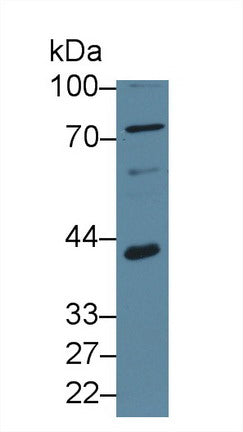 Western Blot; Sample: Recombinant protein.