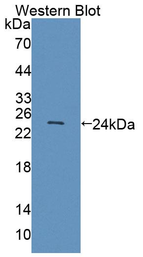 Used in DAB staining on fromalin fixed paraffin- embedded Kidney tissue