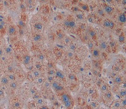 Squamous Cell Carcinoma Antigen 1/2 (SCCA1/SCCA2) Polyclonal Antibody - image 4