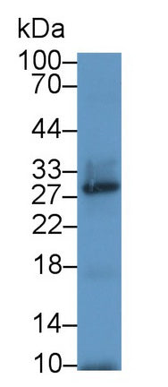 DAB staining on IHC-P; Samples: Human Kidney Tissue;  Primary Ab: 20μg/ml Rabbit Anti-Human UPP1 Antibody Second Ab: 2µg/mL HRP-Linked Caprine Anti-Rabbit IgG Polyclonal Antibody