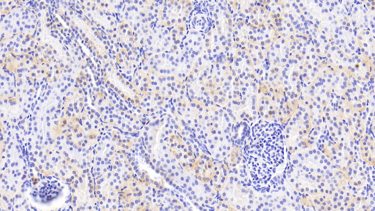 Uridine Phosphorylase 1 (UPP1) Polyclonal Antibody - image 4