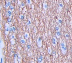 Jagged 1 (JAG1) Polyclonal Antibody - image 4