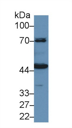 Western Blot; Sample: Recombinant protein.