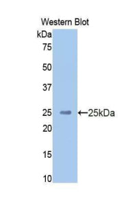DAB staining on IHC-P; Samples: Human Kidney Tissue; Primary Ab: 20μg/ml Rabbit Anti-Human HMWK Antibody Second Ab: 2µg/mL HRP-Linked Caprine Anti-Rabbit IgG Polyclonal Antibody