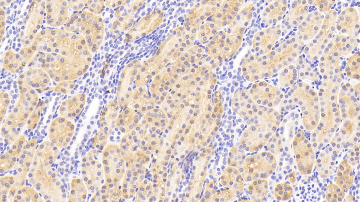 DAB staining on IHC-P. Samples: Human Tissue)