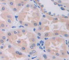 High Molecular Weight Kininogen (HMWK) Polyclonal Antibody - image 3