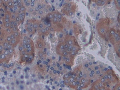 DAB staining on IHC-P; Samples: Rat Spinal Cord Tissue.