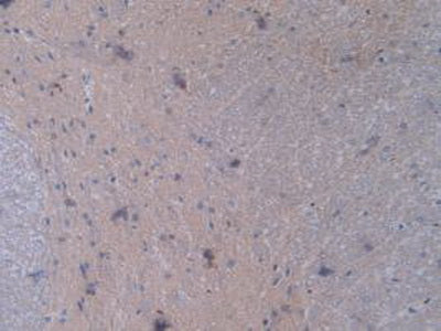 Signal Transducer And Activator Of Transcription 2 (STAT2) Polyclonal Antibody - image 5