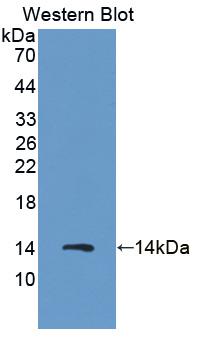 DAB staining on IHC-P; Samples: Porcine Lymph node Tissue; Primary Ab: 10μg/ml Rabbit Anti-Porcine S100A8 Antibody Second Ab: 2µg/mL HRP-Linked Caprine Anti-Rabbit IgG Polyclonal Antibody