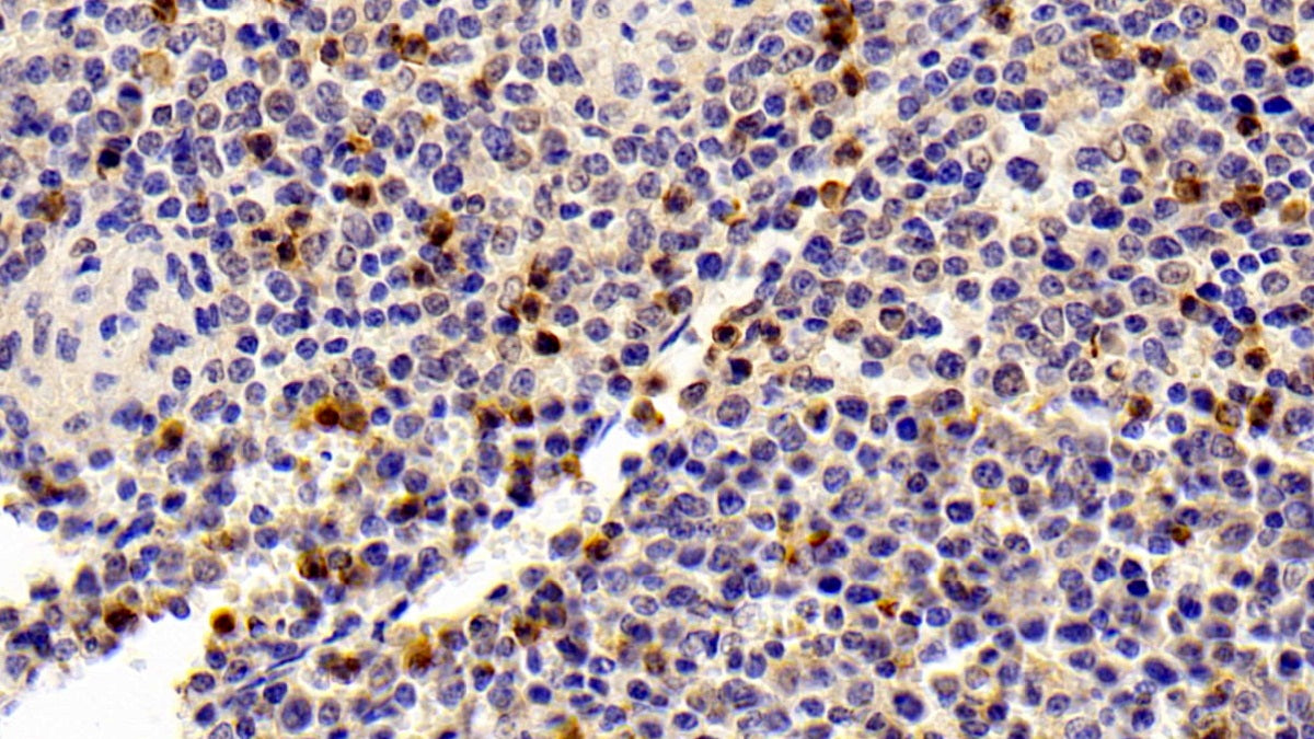 S100 Calcium Binding Protein A8 (S100A8) Polyclonal Antibody - image 5