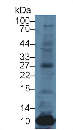 DAB staining on IHC-P; Samples: Mouse Spleen Tissue; Primary Ab: 10µg/ml Rabbit Anti-Mouse S100A8 Antibody Second Ab: 2µg/mL HRP-Linked Caprine Anti-Rabbit IgG Polyclonal Antibody