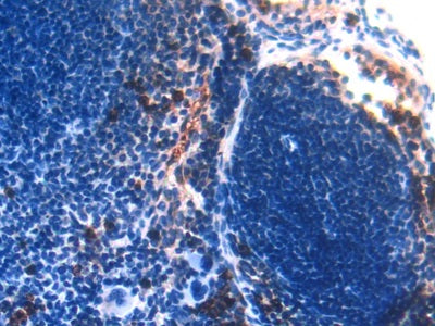 DAB staining on IHC-P; Samples: Mouse Lung Tissue