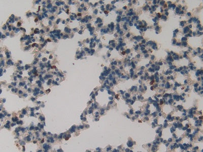 S100 Calcium Binding Protein A8 (S100A8) Polyclonal Antibody - image 5