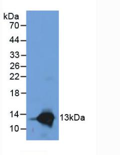 Western Blot; Sample: Recombinant S100A8, Human.