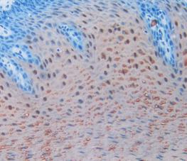 S100 Calcium Binding Protein A8 (S100A8) Polyclonal Antibody - image 5