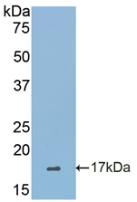 Sialic Acid Binding Ig Like Lectin 7 (SIGLEC7) Polyclonal Antibody - image 2